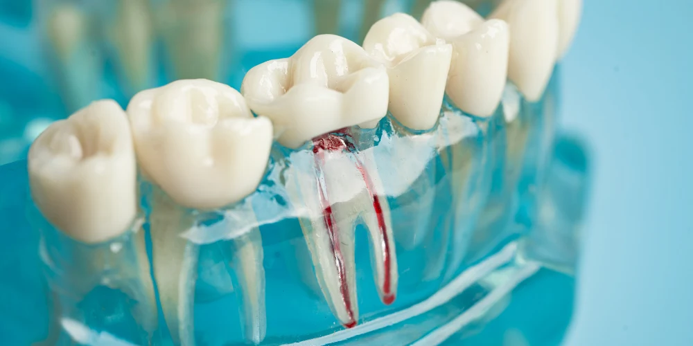 teeth model with root canal